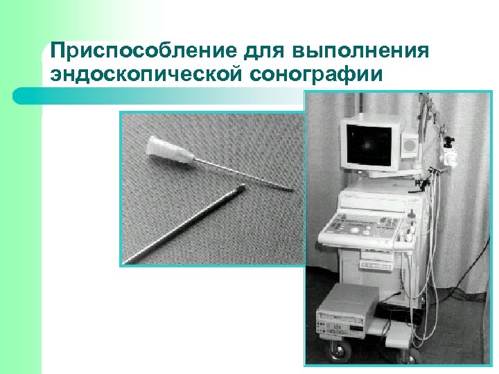 Приспособление для выполнения эндоскопической сонографии 