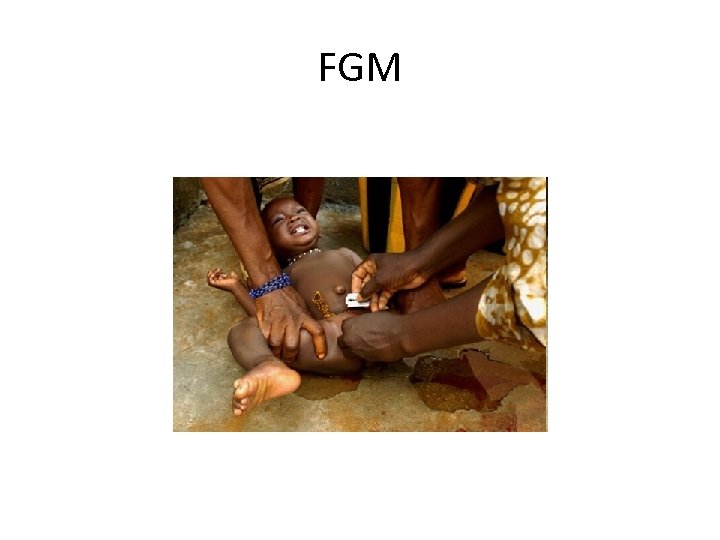 FGM 