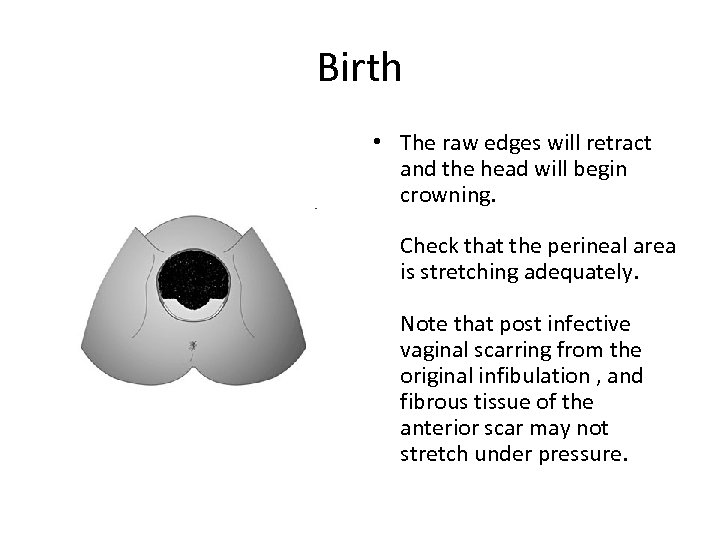 Birth • The raw edges will retract and the head will begin crowning. Check