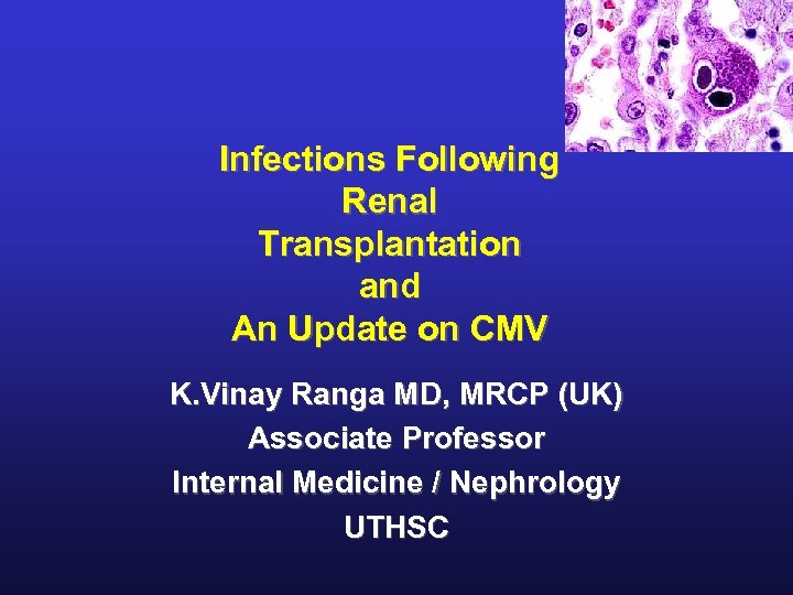 Infections Following Renal Transplantation and An Update on CMV K. Vinay Ranga MD, MRCP
