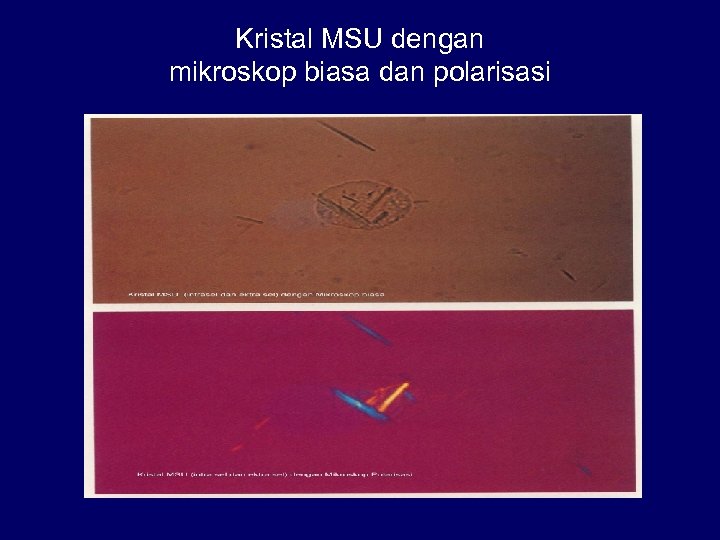 Kristal MSU dengan mikroskop biasa dan polarisasi 