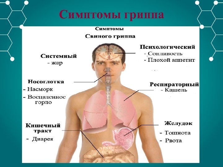 Симптомы гриппа 