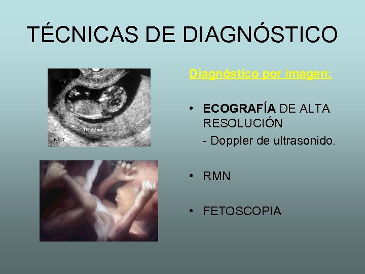 TÉCNICAS DE DIAGNÓSTICO Diagnóstico por imagen: • ECOGRAFÍA DE ALTA RESOLUCIÓN - Doppler de