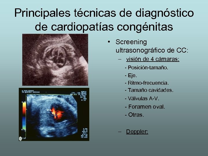 Principales técnicas de diagnóstico de cardiopatías congénitas • Screening ultrasonográfico de CC: – visión