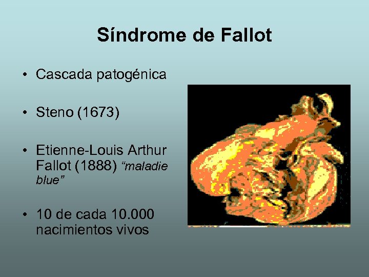 Síndrome de Fallot • Cascada patogénica • Steno (1673) • Etienne-Louis Arthur Fallot (1888)