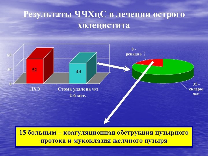 Результаты ЧЧХц. С в лечении острого холецистита 15 больным – коагуляционная обструкция пузырного протока
