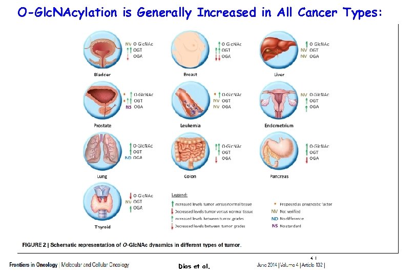 O-Glc. NAcylation is Generally Increased in All Cancer Types: Dias et al. 31 