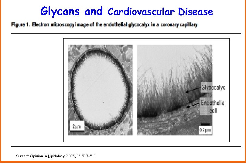 Glycans and Cardiovascular Disease Current Opinion in Lipidology 2005, 16: 507– 511 