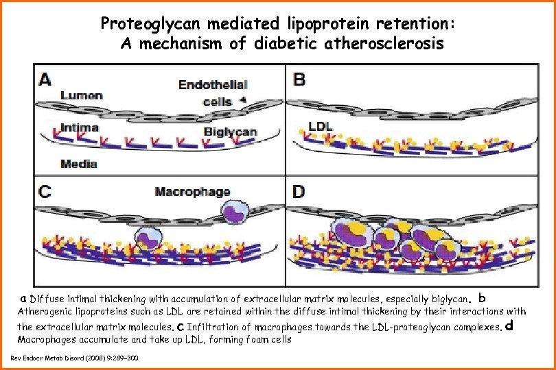 Proteoglycan mediated lipoprotein retention: A mechanism of diabetic atherosclerosis a Diffuse intimal thickening with