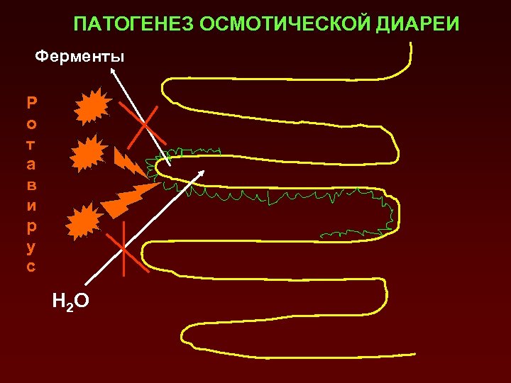 ПАТОГЕНЕЗ ОСМОТИЧЕСКОЙ ДИАРЕИ Ферменты Р о т а в и р у с Н