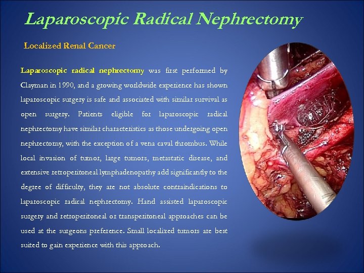 Laparoscopic Radical Nephrectomy Localized Renal Cancer Laparoscopic radical nephrectomy was first performed by Clayman