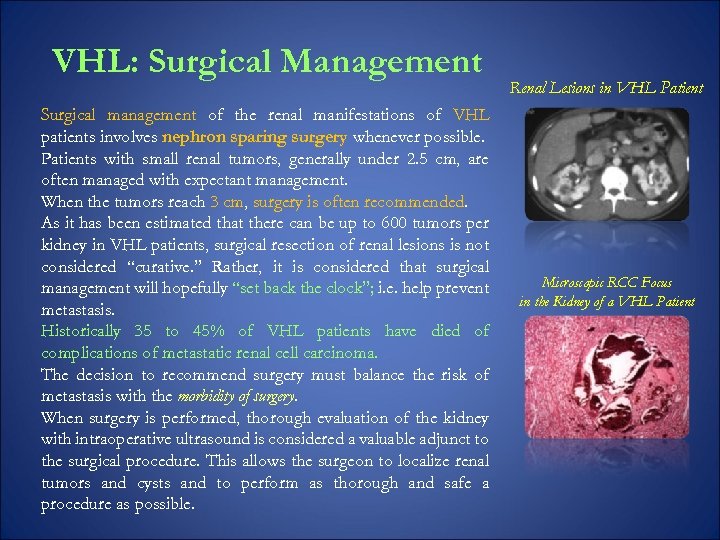 VHL: Surgical Management Surgical management of the renal manifestations of VHL patients involves nephron