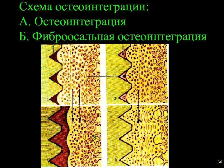 Феномен остеоинтеграции факторы влияющие на оптимизацию этого процесса презентация