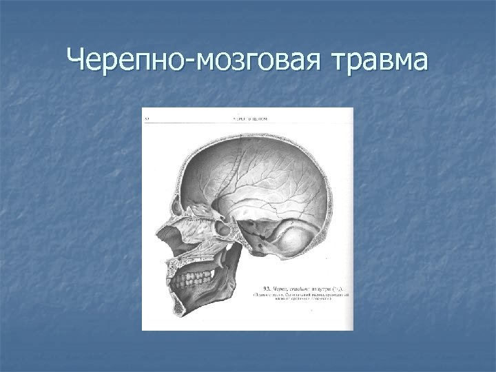 Открытая черепно мозговая травма это