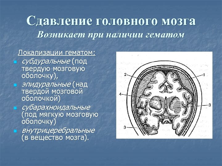 Сдавление головного мозга гематомой