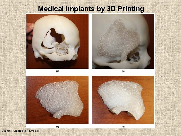 Medical Implants by 3 D Printing Courtesy: Espalin et al. (Emerald), 