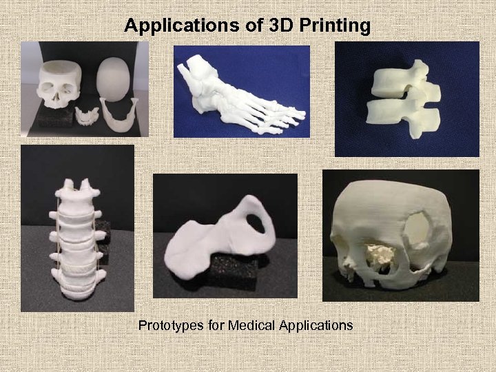 Applications of 3 D Printing Prototypes for Medical Applications 