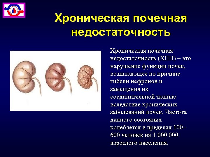 Как происходит почечная недостаточность