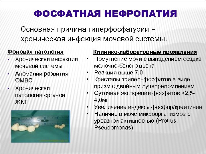 ФОСФАТНАЯ НЕФРОПАТИЯ Основная причина гиперфосфатурии – хроническая инфекция мочевой системы. Фоновая патология • Хроническая