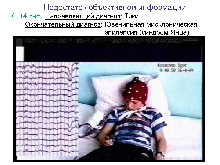 Недостаток объективной информации К. , 14 лет. Направляющий диагноз: Тики Окончательный диагноз: Ювенильная миоклоническая