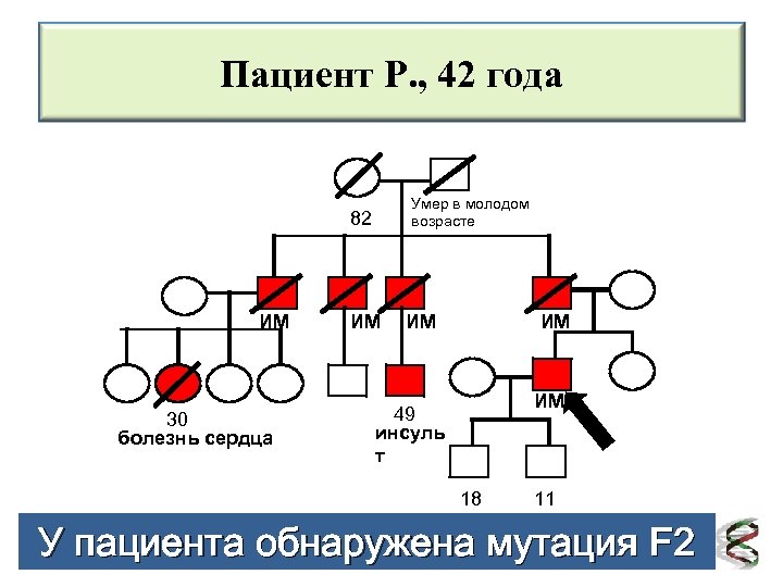 Пациент Р. , 42 года Умер в молодом возрасте 82 ИМ 30 болезнь сердца