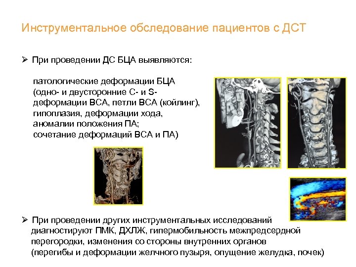 Инструментальное обследование пациентов с ДСТ Ø При проведении ДС БЦА выявляются: патологические деформации БЦА