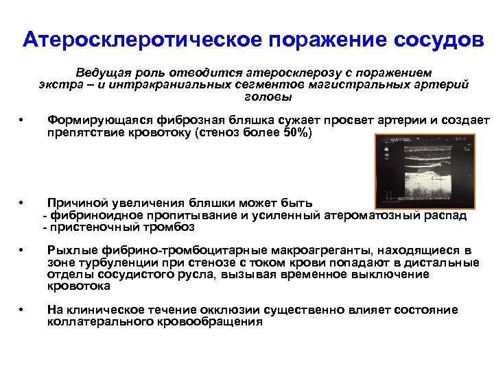 Атеросклеротическое поражение сосудов Ведущая роль отводится атеросклерозу с поражением экстра – и интракраниальных сегментов