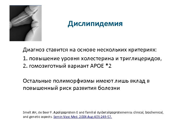 Дислипидемия Диагноз ставится на основе нескольких критериях: 1. повышение уровня холестерина и триглицеридов, 2.