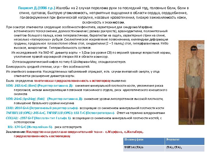 Пациент Д. (1996 г. р. ) Жалобы на 2 случая перелома руки за последний