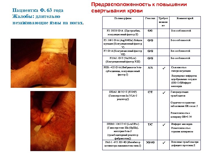 Пациентка Ф. 63 года Жалобы: длительно незаживающие язвы на ногах. Предрасположенность к повышении свертывания
