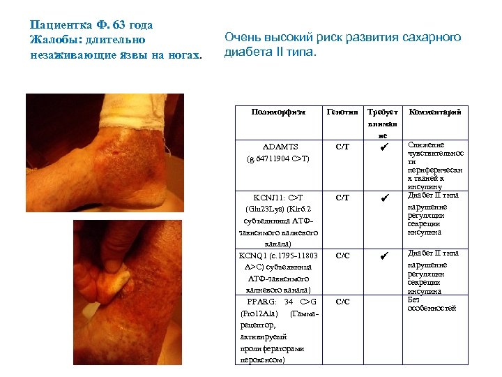 Пациентка Ф. 63 года Жалобы: длительно незаживающие язвы на ногах. Oчень высокий риск развития