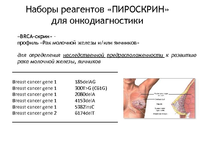 Наборы реагентов «ПИРОСКРИН» для онкодиагностики «BRCA-скрин» – профиль «Рак молочной железы и/или яичников» для