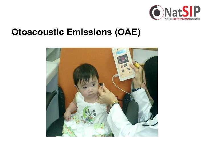 Otoacoustic Emissions (OAE) 