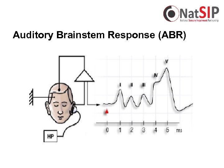 Auditory Brainstem Response (ABR) 
