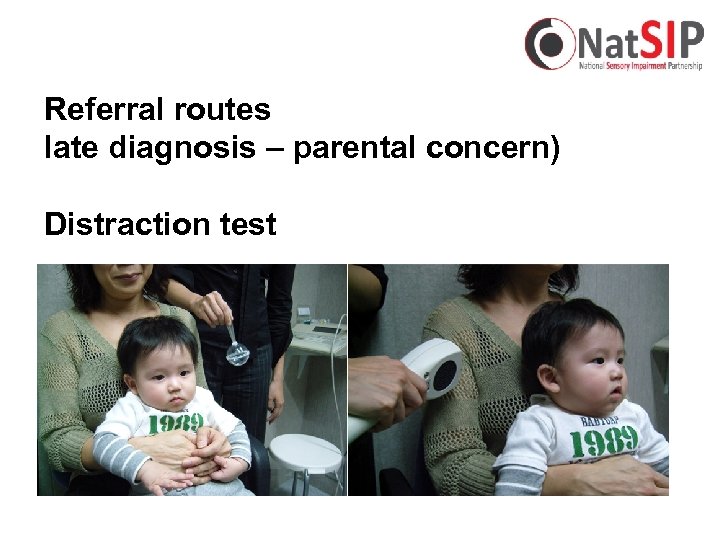 Referral routes late diagnosis – parental concern) Distraction test 