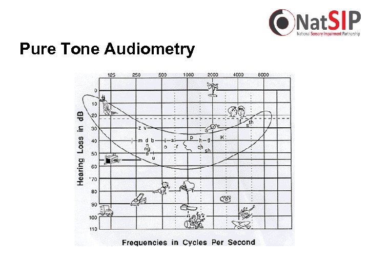 Pure Tone Audiometry 