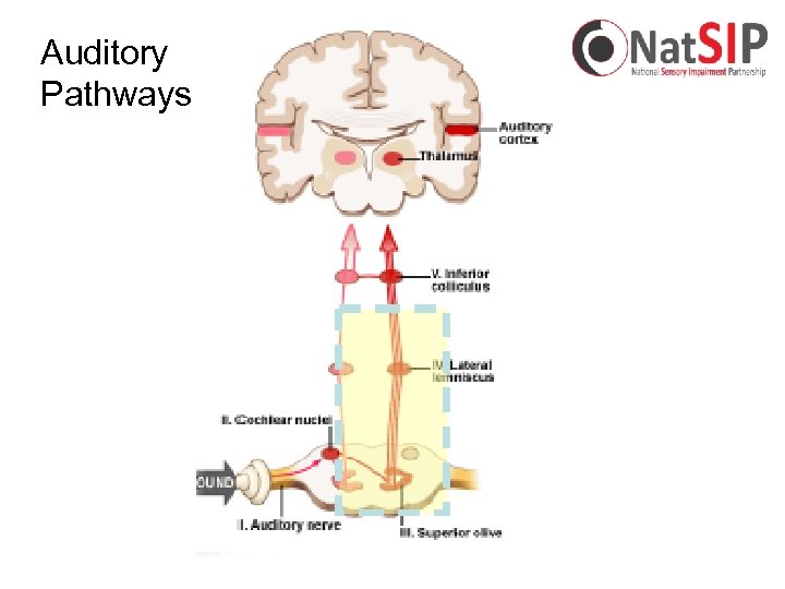 Auditory Pathways 
