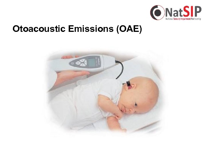 Otoacoustic Emissions (OAE) 