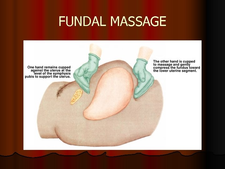 FUNDAL MASSAGE 