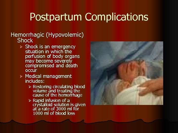 Postpartum Haemorrhage Presentation