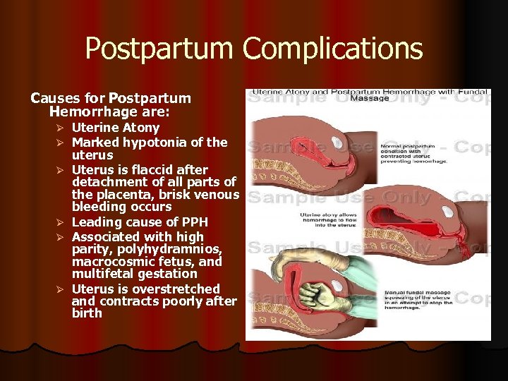 Postpartum Complications Causes for Postpartum Hemorrhage are: Ø Ø Ø Uterine Atony Marked hypotonia