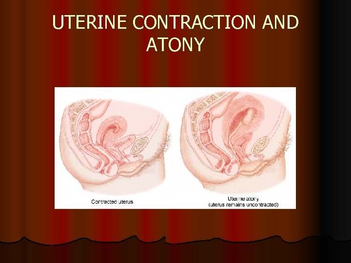 UTERINE CONTRACTION AND ATONY 