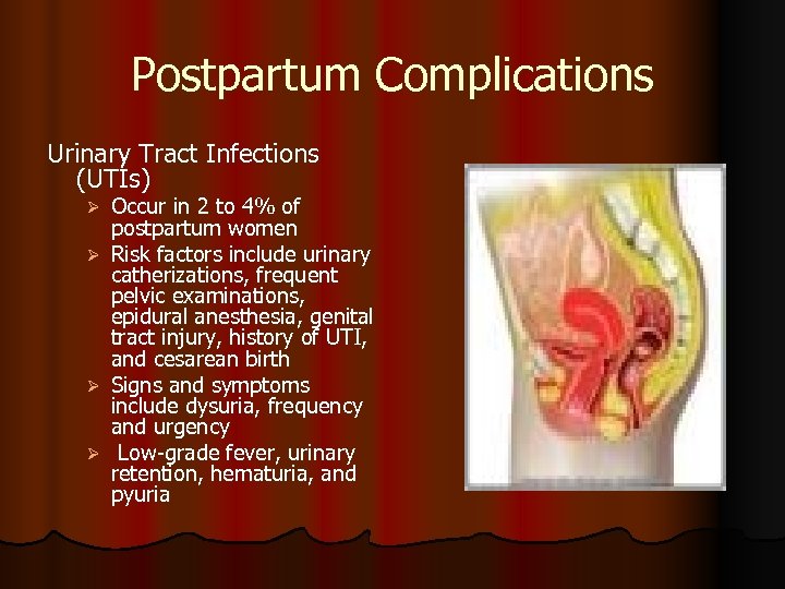 Postpartum Complications Urinary Tract Infections (UTIs) Ø Ø Occur in 2 to 4% of