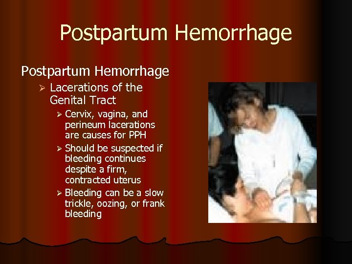 Postpartum Hemorrhage Ø Lacerations of the Genital Tract Ø Cervix, vagina, and perineum lacerations