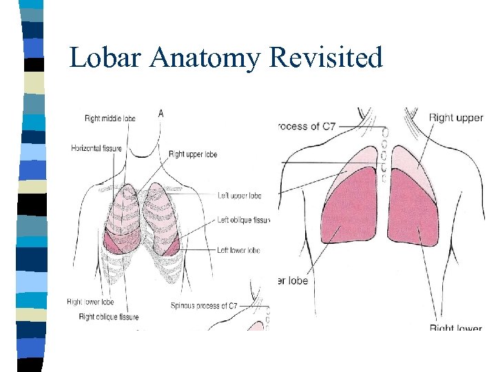 Lobar Anatomy Revisited 