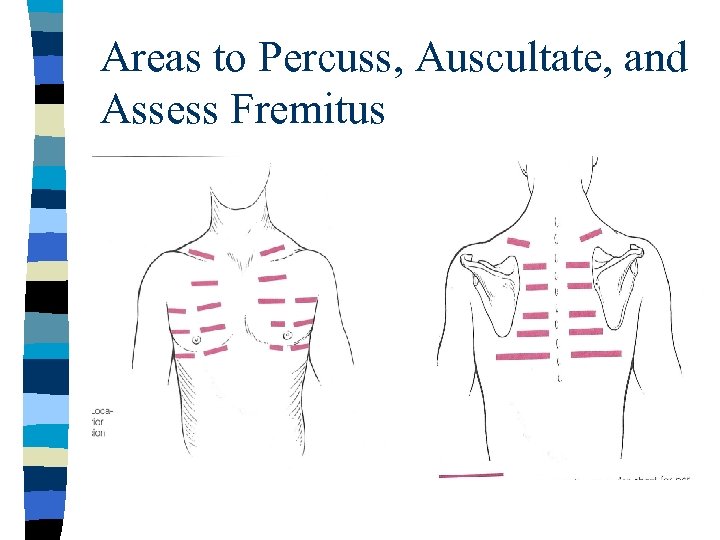 Areas to Percuss, Auscultate, and Assess Fremitus 