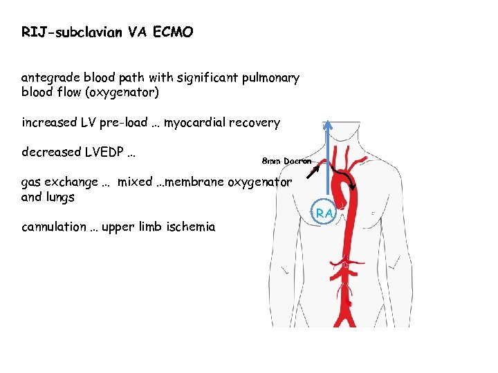 RIJ-subclavian VA ECMO antegrade blood path with significant pulmonary blood flow (oxygenator) increased LV