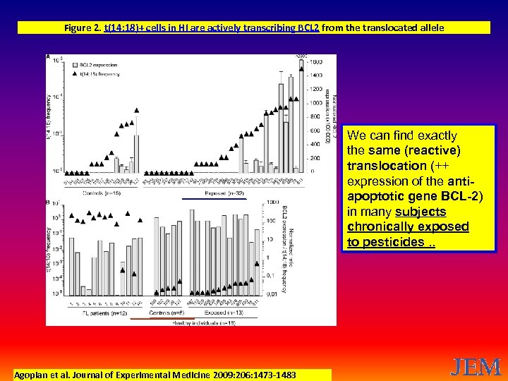 Figure 2. t(14; 18)+ cells in HI are actively transcribing BCL 2 from the