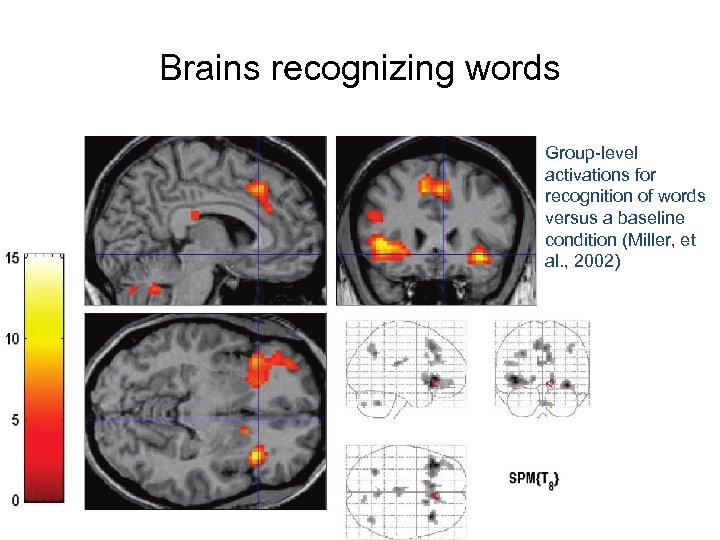 Brains recognizing words Group-level activations for recognition of words versus a baseline condition (Miller,