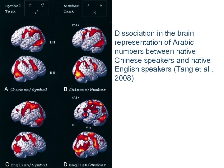Dissociation in the brain representation of Arabic numbers between native Chinese speakers and native